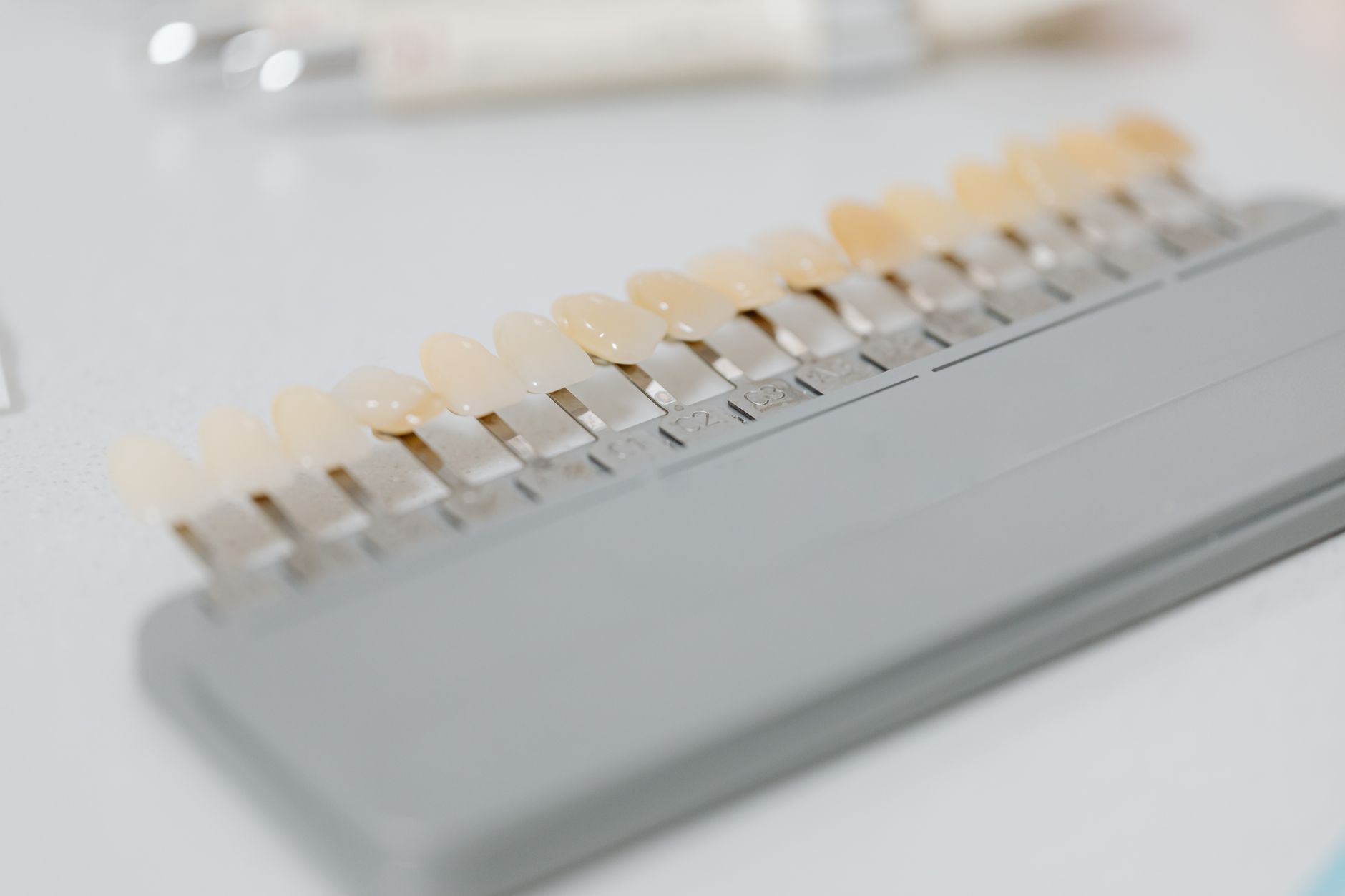 eMax Veneers: Die 6 wichtigsten Nachteile, die Sie vor der Entscheidung kennen sollten