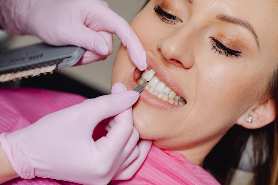 Veneers Istanbul: Kompletter Guide 2026 — Kosten, Kliniken & Erfahrungen