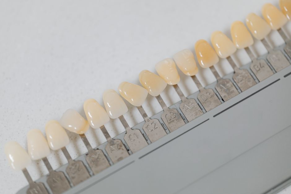 Veneers in Istanbul Türkei