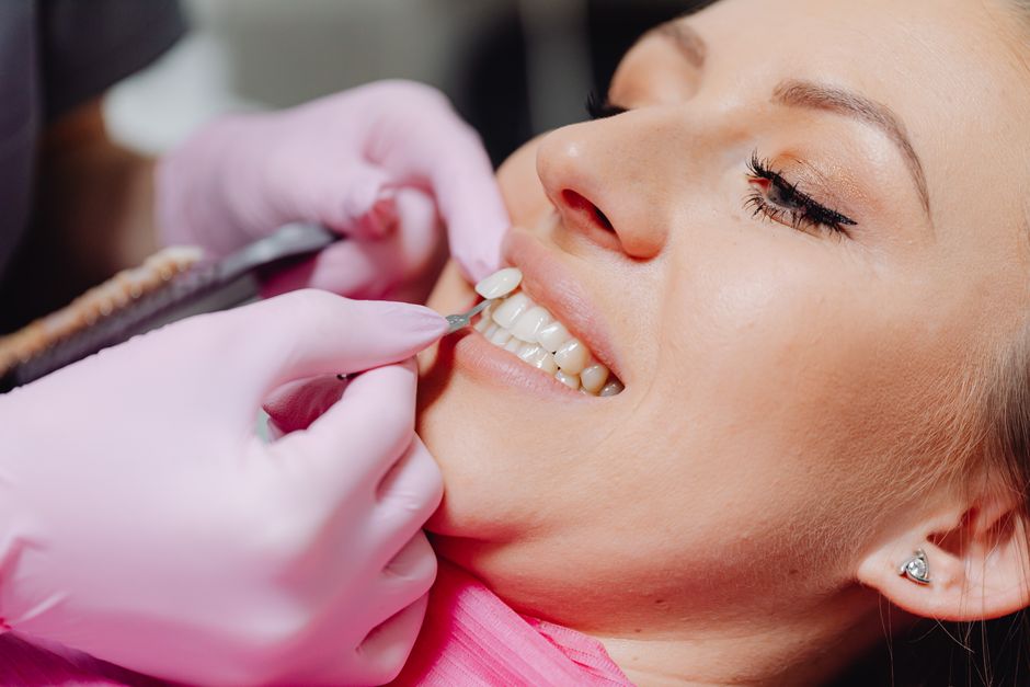 Veneers Kosten Türkei 2026: Preise, Vergleich & Tipps