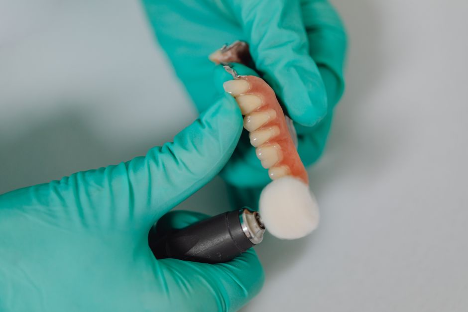 Zahnimplantat Haltbarkeit: Wie lange halten Implantate wirklich?